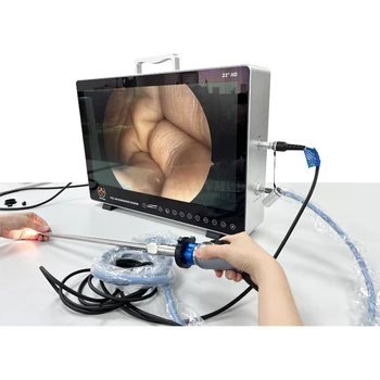 Система на камера за ендоскопска хирургия на гръбначния стълб САЙ-PS050 HD-ендоскоп