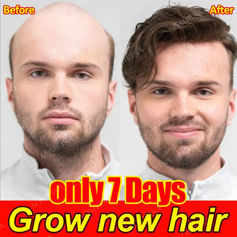 Мощен растеж на косата, защита от косопад, Защита от косопад, за Бърз растеж на косата, лечение на косопад, бързо прераждане на косата1
