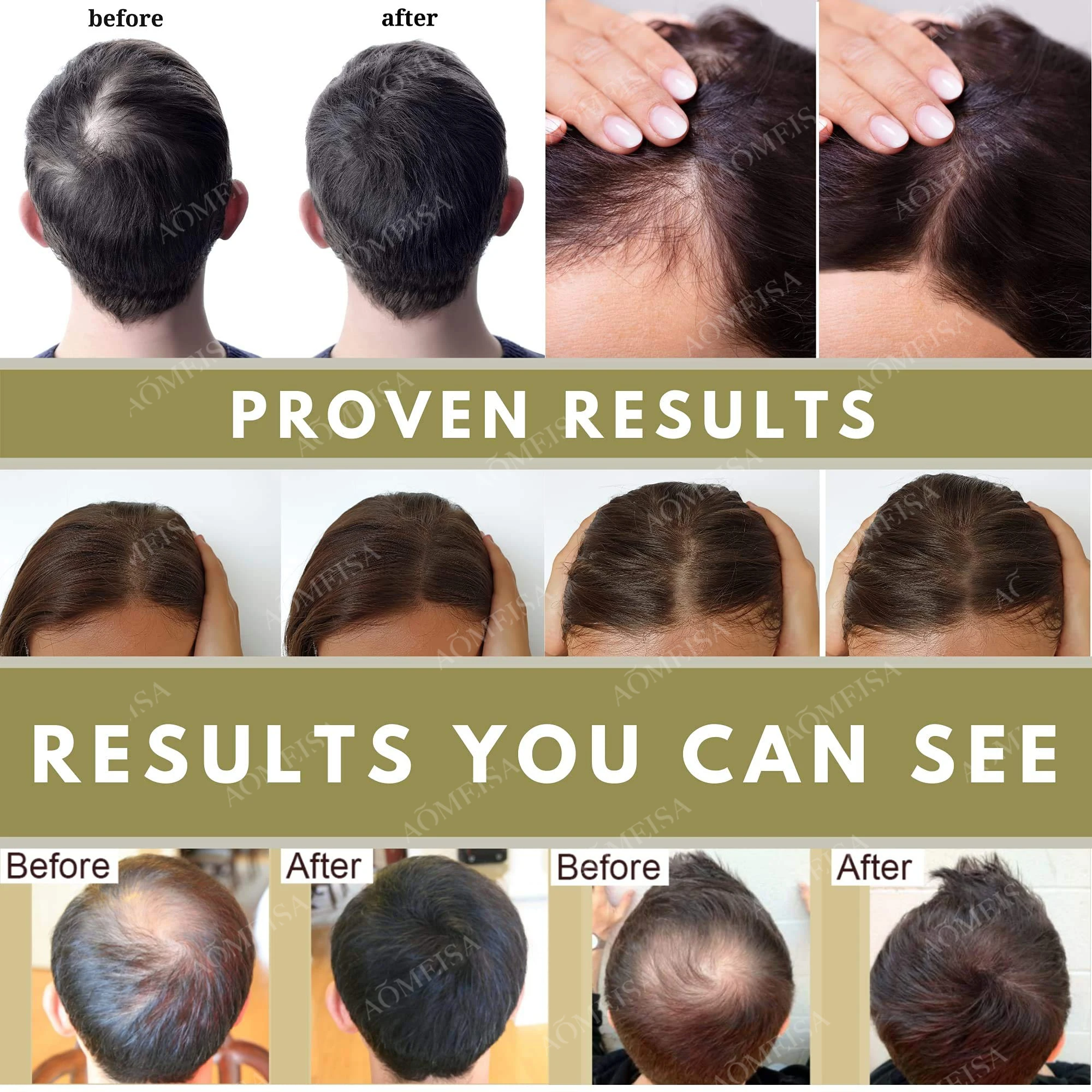 Мощен растеж на косата, защита от косопад, Защита от косопад, за Бърз растеж на косата, лечение на косопад, бързо прераждане на косата4