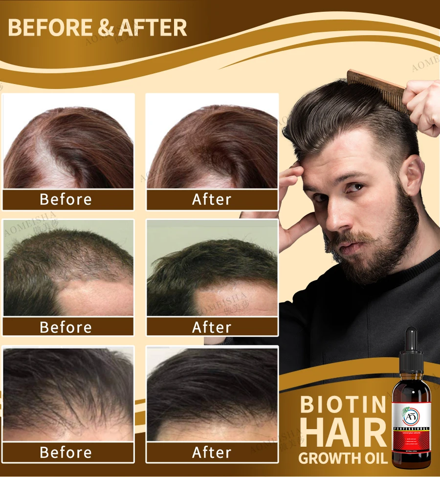 Мощен растеж на косата, защита от косопад, Защита от косопад, за Бърз растеж на косата, лечение на косопад, бързо прераждане на косата5